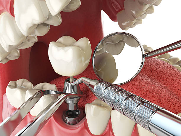 Professional Emergency Dental Service in AL